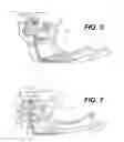Fig. 06 - Firearm laser sight alignment assembly