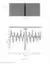 Fig. 08 - Determination of operability of a digital scanner with shearing interferometry