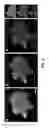 Fig. 06 - Total internal reflection and transmission illumination fluorescence microscopy imaging system with improved background suppression
