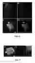 Fig. 07 - Total internal reflection and transmission illumination fluorescence microscopy imaging system with improved background suppression