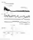 Fig. 11 - METHODS FOR TREATING NEURAL CELL SWELLING