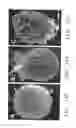 Fig. 15 - METHODS FOR TREATING NEURAL CELL SWELLING