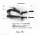 Fig. 12 - Method of treating cervical neoplasia in patients infected with human papilloma virus