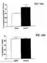 Fig. 28 - Future cardiac event biomarkers CCL3, CCL5, and CCL18