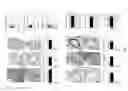 Fig. 02 - Inhibitors of IGFBP3 binding to TMEM219 for treatment of intestinal diseases