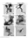 Fig. 10 - DETECTION OF INFECTIOUS PRION PROTEIN BY SEEDED CONVERSION OF RECOMBINANT PRION PROTEIN