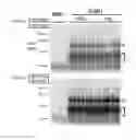 Fig. 19 - DETECTION OF INFECTIOUS PRION PROTEIN BY SEEDED CONVERSION OF RECOMBINANT PRION PROTEIN