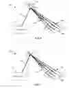 Fig. 06 - LASER REPEATER