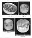 Fig. 06 - High-performance composite scintillator