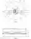 Fig. 02 - Aerial micromodule optical cable and a method of manufacturing said cable