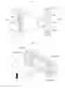 Fig. 07 - Auto-focusing apparatus having asymmetric supporting structure