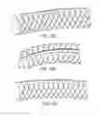 Fig. 09 - Signal infusion to enhance appendage detection and characterization