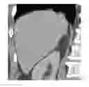 Fig. 01 - Online learning enhanced atlas-based auto-segmentation