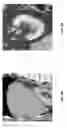 Fig. 07 - Online learning enhanced atlas-based auto-segmentation