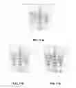 Fig. 09 - Methods and systems for emission computed tomography image reconstruction