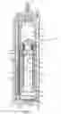 Fig. 05 - Infusion systems and methods for prospective closed-loop adjustments
