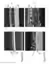 Fig. 23 - Surface activation in electrode stack production and electrode-preparation systems and methods
