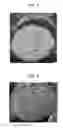 Fig. 04 - Lithium secondary battery