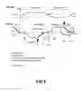 Fig. 06 - Method and circuit for driving single coil BLDC motor