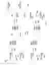 Fig. 07 - Prefetcher in multi-tiered memory systems