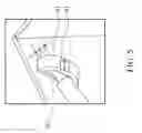 Fig. 06 - Electronic device and metal housing thereof
