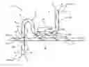 Fig. 01 - COMPRESSION FIT HEAT SINK FOR ELECTRONIC COMPONENTS