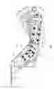 Fig. 02 - Telescopic roller support for sugarcane knockdown roller