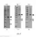 Fig. 05 - Humanized skeletal muscle