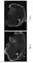 Fig. 07 - Humanized skeletal muscle