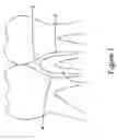 Fig. 02 - INTERDENTAL BRUSH AND METHOD FOR USE THEREOF