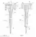 Fig. 04 - Illuminated Endoscopic Pedicle Probe With Electromyographic Monitoring
