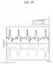 Fig. 27 - Touch-type blood pressure measurement apparatus and method