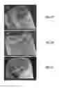 Fig. 02 - Implantable micro-component electrodes
