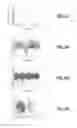 Fig. 24 - Implantable micro-component electrodes