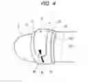 Fig. 05 - Attachment tape and pulse photometry probe
