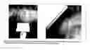 Fig. 46 - High performance sensors for electrical impedance myography
