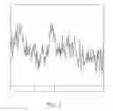 Fig. 06 - MR spectroscopy system and method for diagnosing painful and non-painful intervertebral discs