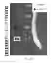 Fig. 32 - MR spectroscopy system and method for diagnosing painful and non-painful intervertebral discs