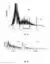 Fig. 04 - Device for measuring muscle signals