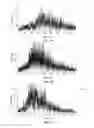 Fig. 06 - Device for measuring muscle signals