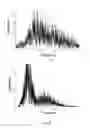 Fig. 08 - Device for measuring muscle signals