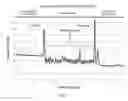 Fig. 03 - Systems, devices and methods for sensing physiologic data and draining and analyzing bodily fluids