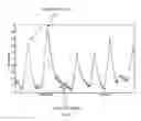 Fig. 04 - Systems, devices and methods for sensing physiologic data and draining and analyzing bodily fluids