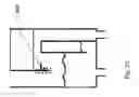 Fig. 23 - Systems, devices and methods for sensing physiologic data and draining and analyzing bodily fluids