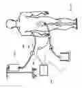 Fig. 29 - Systems, devices and methods for sensing physiologic data and draining and analyzing bodily fluids