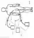 Fig. 30 - Systems, devices and methods for sensing physiologic data and draining and analyzing bodily fluids