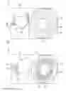 Fig. 03 - Pulmonary vein display in two dimensions