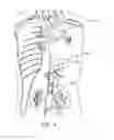 Fig. 05 - Implantable devices and related methods for heart failure monitoring
