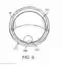 Fig. 09 - Implantable devices and related methods for heart failure monitoring