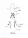 Fig. 19 - Implantable devices and related methods for heart failure monitoring